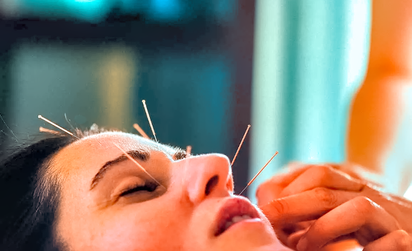 Acupuncture is a scam
